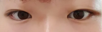 Đây là bài review của mình về Viện trưởng Son Won-il tại Thẩm mỹ viện Very Good.