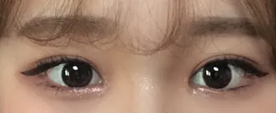 Mình đã thực hiện nhấn mí tự nhiên và mở rộng góc mắt trong tại Thẩm mỹ viện Very Good!