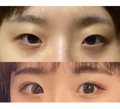 Ban đầu mắt mình trông khá bí bách nhưng giờ chắc chắn là cảm giác đó đã hoàn toàn biến mất rồi, mình thực sự rất hài lòng!!