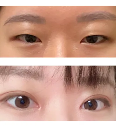 Mình cực kỳ đề xuất Thẩm mỹ viện Very Good ^ㅡ^