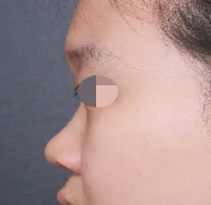 Mình rất cảm ơn Viện trưởng Lim Young-min và mình muốn nhiệt tình giới thiệu cho những ai đang có cùng nỗi lo lắng như mình~^^