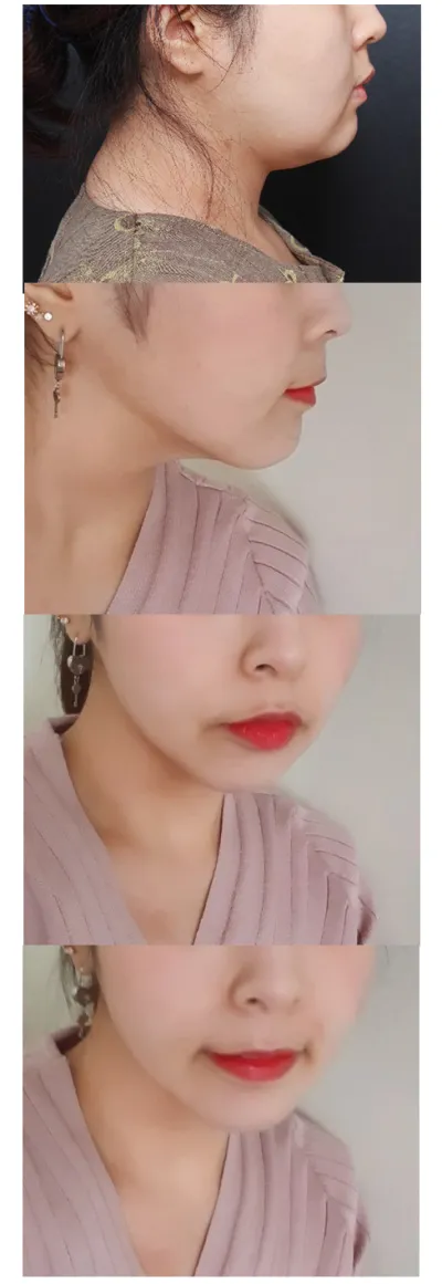 Mình sẽ tiếp tục chăm sóc thật tốt ạ!! Cảm ơn viện trưởng ạ!!