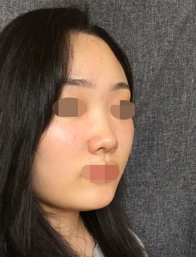 Viện trưởng đã chỉ ra những điểm cần cải thiện một cách rất khách quan, và khi mình đặt câu hỏi về thiết kế, viện trưởng cũng nói trước những phần không thể thực hiện được và tư vấn rất thành thật nên mình thấy thích hơn.