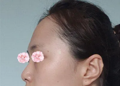 Cả quản lý và viện trưởng đều rất thân thiện, mình rất hài lòng với cả sống mũi và đầu mũi !!