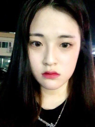 Mình hạnh phúc quá~~~ Đã 6 tháng kể từ khi mình phẫu thuật và giờ thì hầu hết mọi người thực sự không biết là mình đã phẫu thuật nữa.