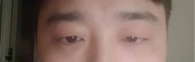 Mình viết hơi lộn xộn. Mình cực kỳ đề xuất chỉnh hình mắt ở Very Good!!!!