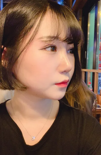 Mình rất hài lòng với cắt mí lần đầu, chỉnh hình dáng mắt, mở góc mắt trong, mở góc mắt kép, sống mũi, đầu mũi và chỉnh mũi gồ.