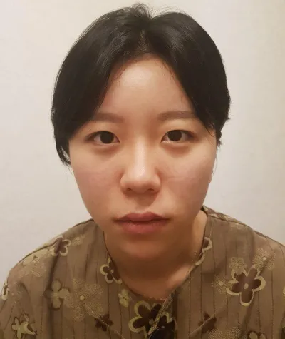 Những bạn đang phân vân về việc cắt mí thì mình khuyên nhất định hãy làm đi!