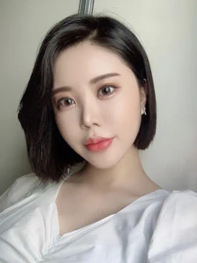 Mình đã phẫu thuật lại mũi, căng chỉ, cấy mỡ toàn mặt và hút mỡ nọng cằm.