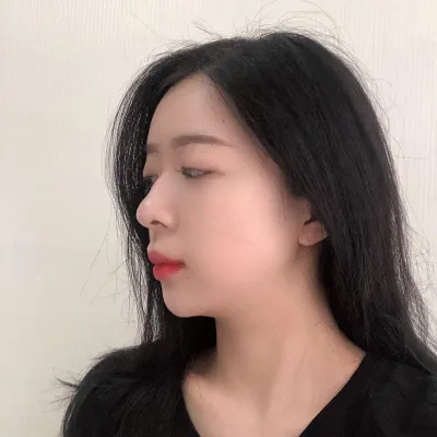 Đây là review phẫu thuật mũi tháng thứ 3 của mình~ㅎㅎ