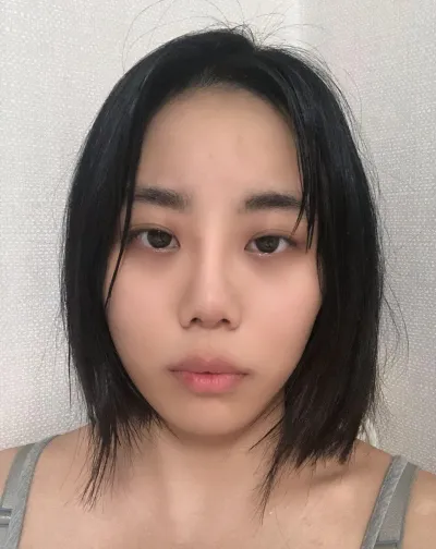 Bây giờ sưng đã hết hẳn, mắt mình to ra một cách tự nhiên theo đúng đường mí mà mình hằng mong muốn nên mình đang rất rất hài lòng ㅠㅠ