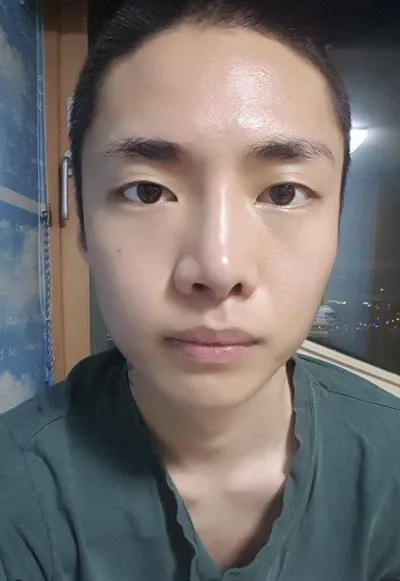 Chào mọi người~~ Đây là review phẫu thuật mắt và phẫu thuật lại mũi của mình!!