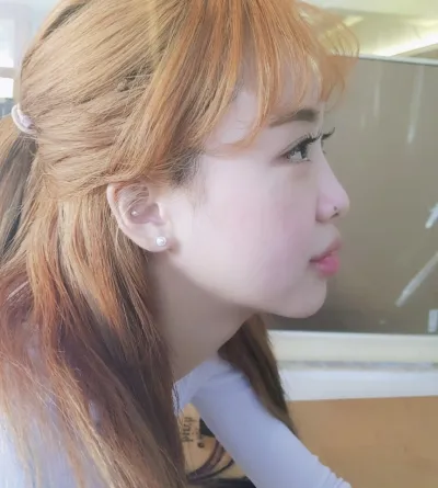 Nhấn mí, liên kết tự nhiên, chỉnh hình mắt, mở rộng góc mắt trước, sau, dưới, mình làm hết sạch luôn!