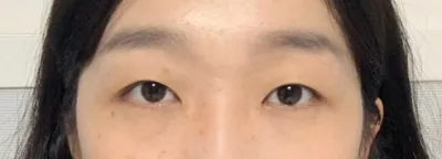 Mình đăng review cắt mí đây!! hihi