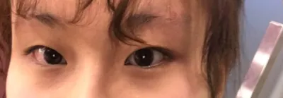 Mình đã tìm được địa chỉ cắt mí chân ái rồi!!