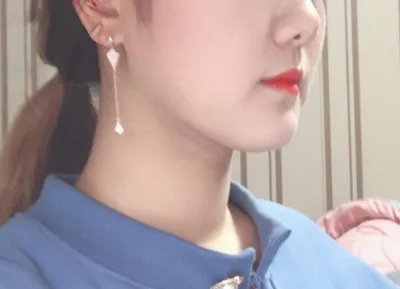 Cuối cùng mình cũng đã hút mỡ rồi ㅠㅠ