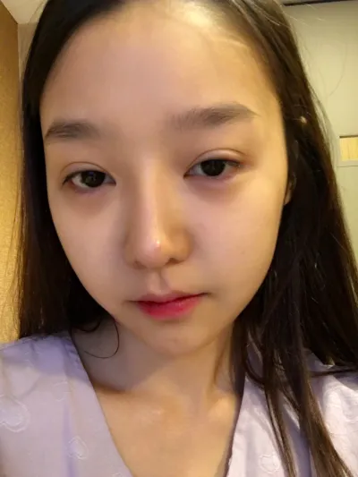 Đừng băn khoăn về phẫu thuật lại nữa, hãy thực hiện tại Very Good nhé.