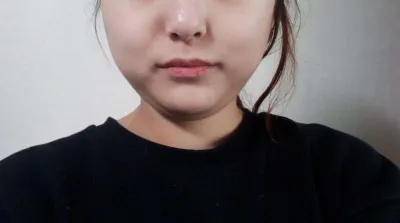 Lần đầu tiên trong đời mình đi hút mỡ~!