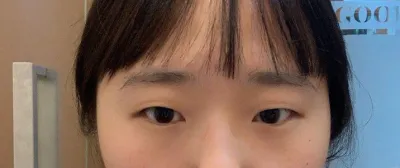 Mình thấy thật đúng đắn khi làm mắt hai mí ㅠㅠ