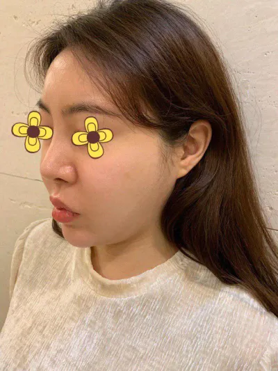 Thật tốt khi mình đã làm căng chỉ ㅠㅠ