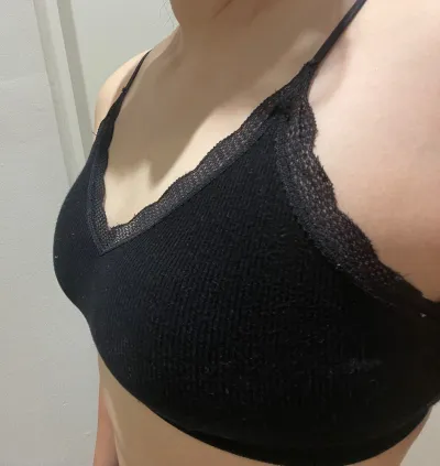 6 tháng sau phẫu thuật nâng ngực chảy xệ của mình