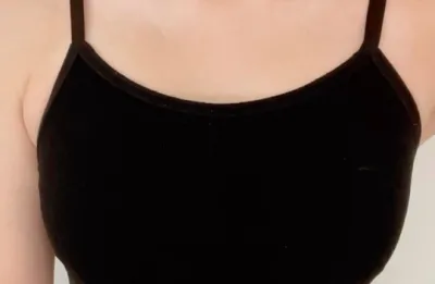 Motiva 2 tháng) Thỉnh thoảng mình cũng quên mất là mình đã phẫu thuật.