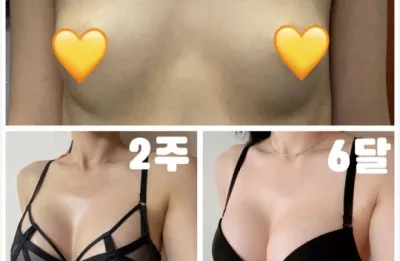 (Sebin Serve 6 tháng) Mình đang mong đợi đến mốc 1 năm :)