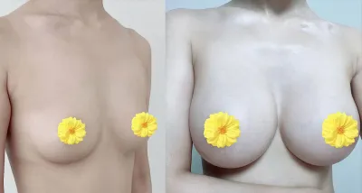 Motiva tháng thứ 6) Đúng là mình không hối hận khi chọn Melon❤️