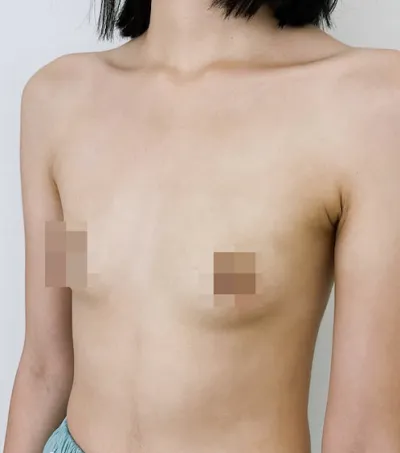 Motiva tháng thứ 1) Mình khuyên nên làm khi còn trẻ, dù chỉ là sớm hơn một tuổi! (Cảnh báo bài viết dài)