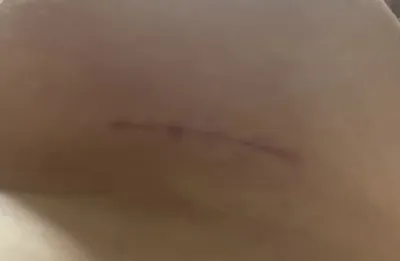 Mình đã đặt lịch vì được tư vấn một cách thành thật sao cho phù hợp với dáng ngực của mình ☺️