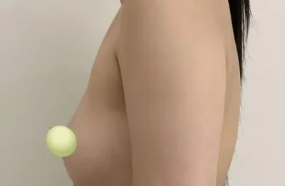 Vết sẹo của mình nhỏ nhất và không nhìn thấy được luôn kk.