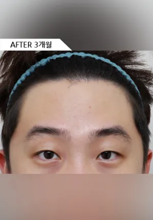 After