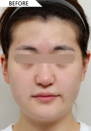 Before