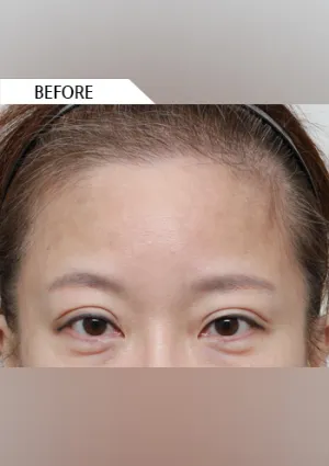 Before