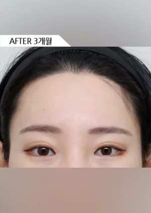 After