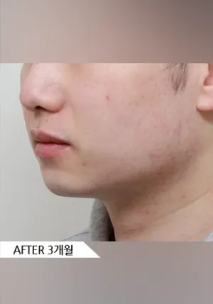 After