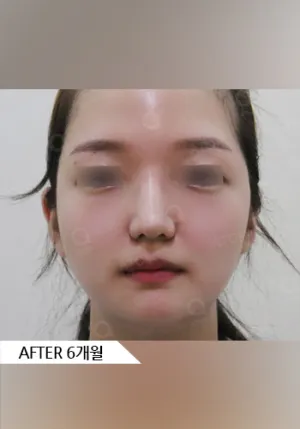 After
