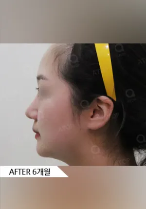 After