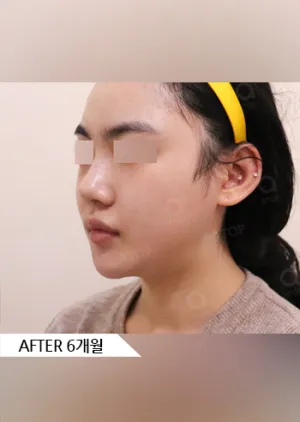 After