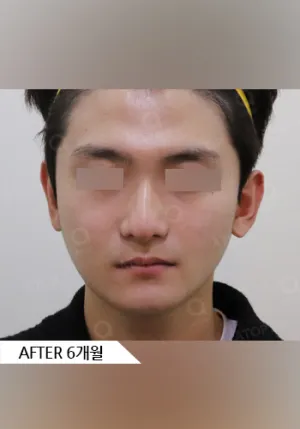 After