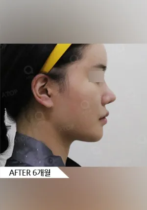 After