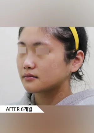 After