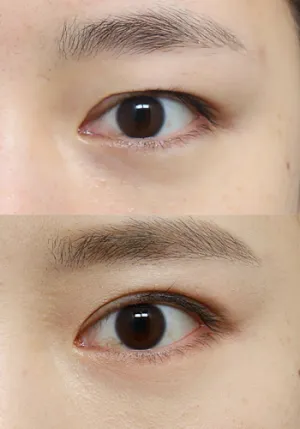 After