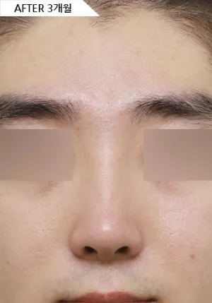 After