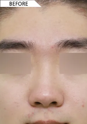 Before