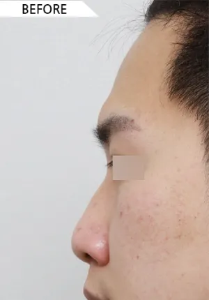 Before