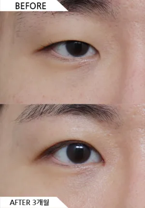 Before