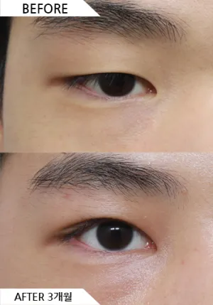 Before
