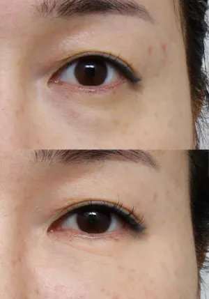 After