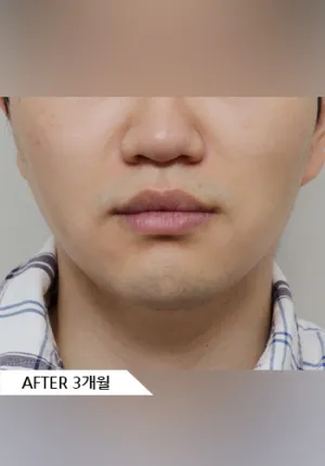 After